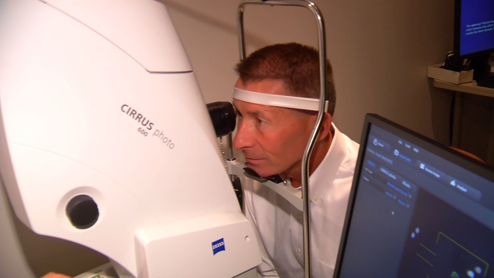 Advanced Retinal Imagining Analysis